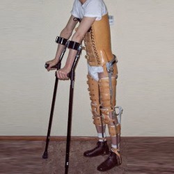 Paraplegic Brace (HKAFO)
